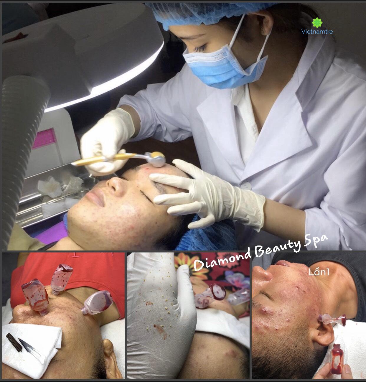 Các dịch vụ tại Diamond Beauty Spa được khách tin dùng hằng ngày 