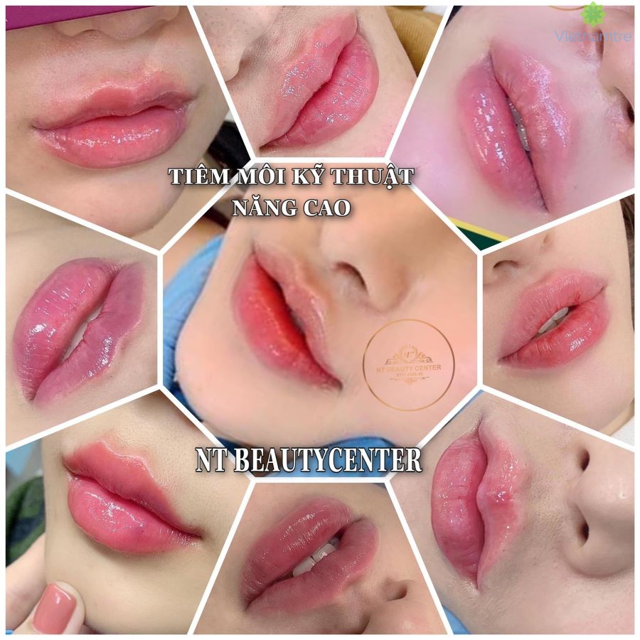 Những dịch vụ thẩm mỹ không phẫu thuật sắp trở thành xu thế