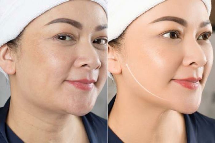 Làn da căng mịn luôn là niềm khao khát của chị em phụ nữ.