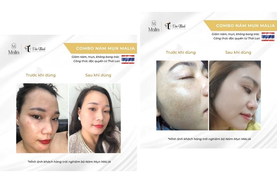 Malia cam kết hiệu quả sau một thời gian sử dụng