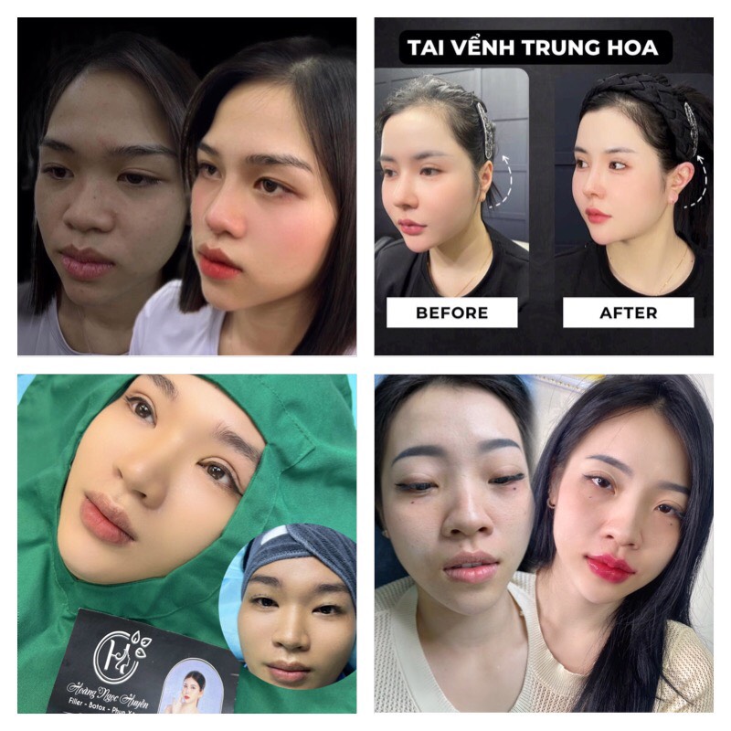 Thăng hạng nhan sắc sau quá trình thẩm mỹ tại Hoàng Ngọc Huyền Beauty Academy
